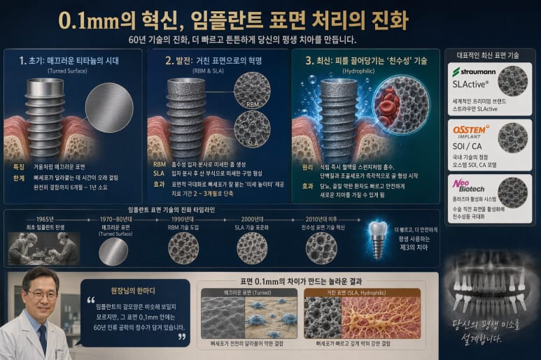 임플란트 표면처리의 발전과정을 설명하고 있음 